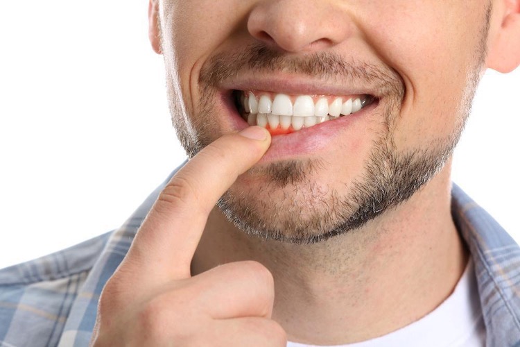 The Dangers of Untreated Gum Disease